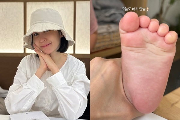 초아 소셜미디어
